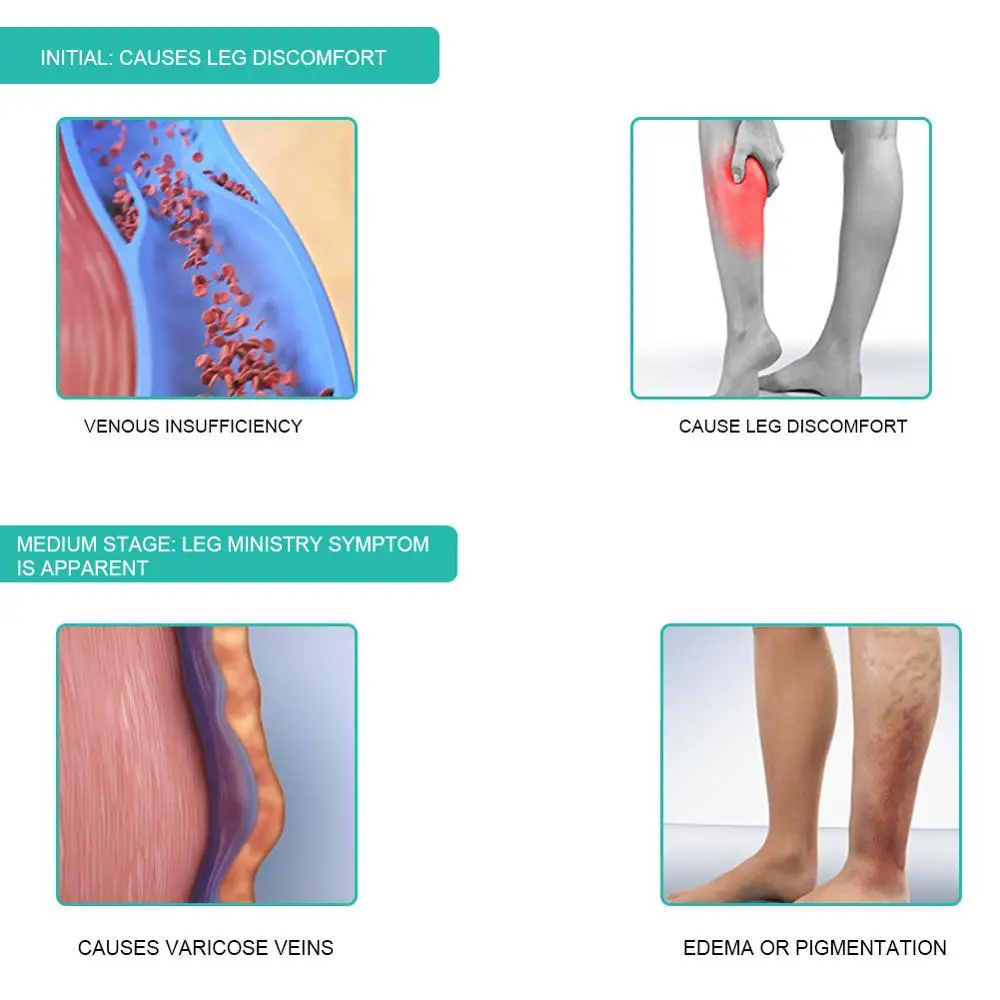 1 par de calcetines de compres - Compression Sock Medical reseña y precio